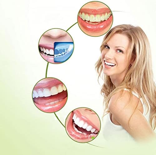 Изкуствени Зъби, Протези за Зъби Временни Външни Винирами, Зъбни Фасети за Временно Възстановяване на зъби, Предпазват