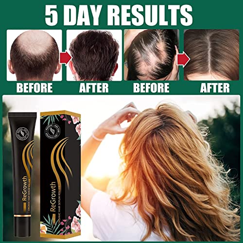 2 БР., Ролка с органични Серум за коса Regrowth, За Растежа на косата за мъже и Жени, Копър За Растежа на Косата С