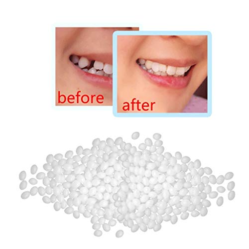 И Набор от лепило FalseTeeth Пространствата между зъбите на Зъбни Протези Твърди Временни Лепило Зъби Домашни занаяти Чувствителни зъби (Бяла, един размер)