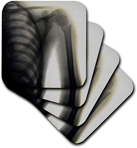 3D Роза Ретро рентгенова снимка на човешкото рамо Магически Фенер Слайд Медицински 1890 Меки Подложки, Многоцветен